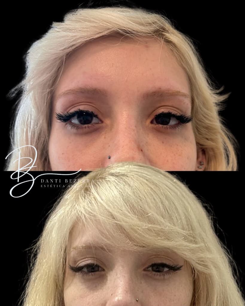 Antes e depois: elevação do olhar com técnica Fox Eyes
